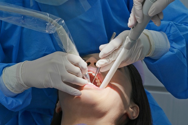 What Makes A Deep Teeth Cleaning Different From A Routine Visit?