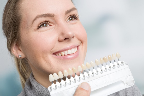 Ways To Prepare For Dental Veneers