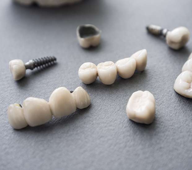 Rancho Cucamonga The Difference Between Dental Implants and Mini Dental Implants